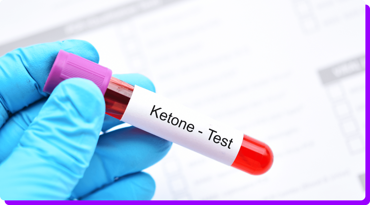 Ketone Bluttest